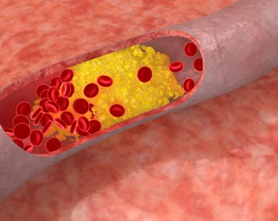 Cholesterol ảnh hưởng đến “chuyện ấy” thế nào?