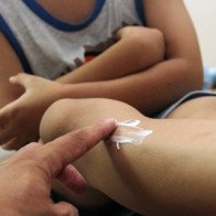 Sử dụng thuốc chống muỗi, côn trùng: Dùng sai, rước độc vào người