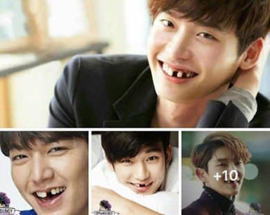 “Cười té ghế” khi thấy các mỹ nam Hàn Quốc bất ngờ bị… sún răng