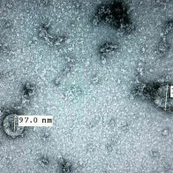 Việt Nam nuôi cấy thành công nCoV