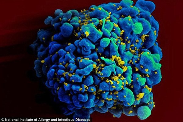 Tìm ra vắc xin phòng HIV? 