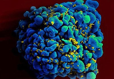 Đã tìm ra vắc-xin phòng HIV?