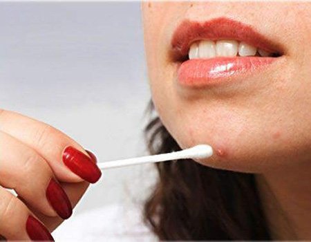 Trị nhanh mụn mùa hè với 4 chiêu cực độc