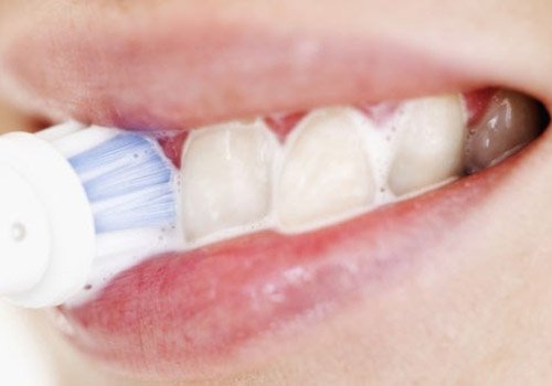 3 bí quyết tẩy răng trắng tinh tại nhà