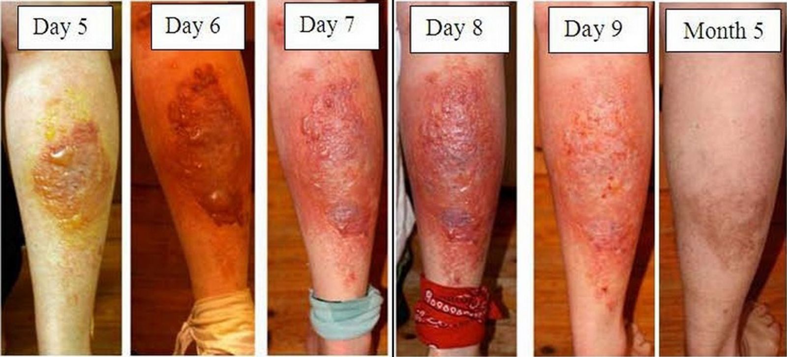 Loài cây kỳ lạ có thể gây mù mắt vĩnh viễn chỉ bằng một lần chạm