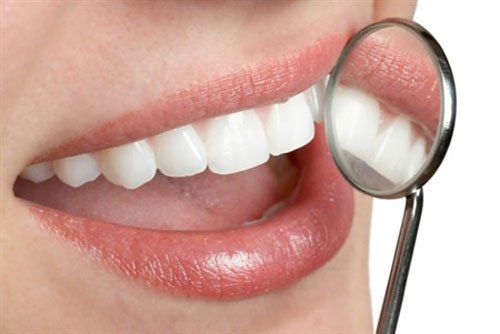 Cách chữa chảy máu chân răng, viêm lợi cực hiệu nghiệm