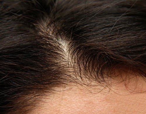 Mách bạn cách bảo vệ mái tóc trong mùa hanh khô