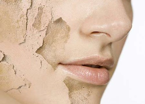 Giải quyết nhiều vấn đề về da khi đông tới