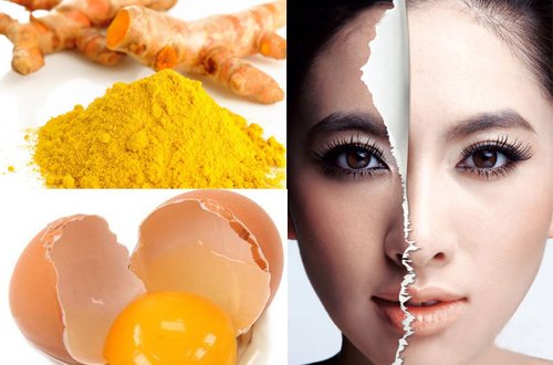 Công thức trị nám da giá chưa tới 10k