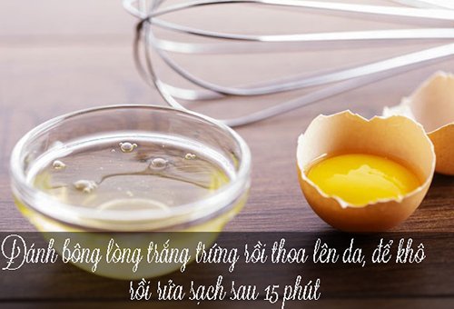 5 mẹo chữa bỏng nắng vừa nhanh vừa hiệu quả