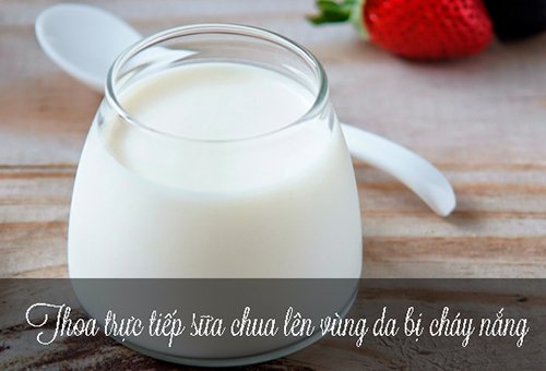 5 mẹo chữa bỏng nắng vừa nhanh vừa hiệu quả