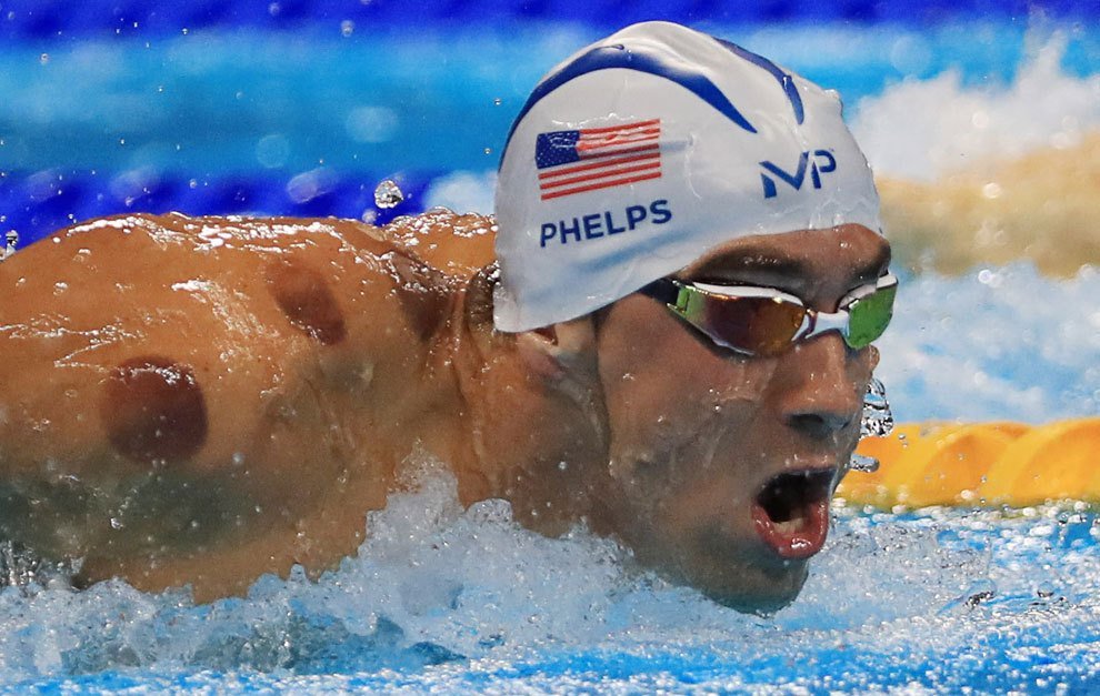 Michael Phelps giành HCV nhờ phương pháp cổ đại của Trung Quốc