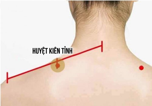 3 huyệt bạn cần bấm để chữa bệnh thoái hóa đốt sống cổ, đau cổ