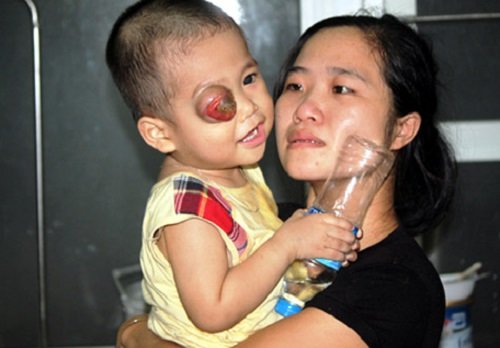 Người Việt giật mình vì nguy cơ gây ung thư nhan nhản khắp nơi